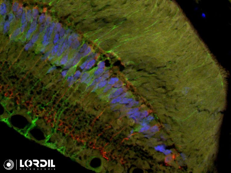 Echantillon Fluorescent au confocal Maico Hamamatsu par Lordil