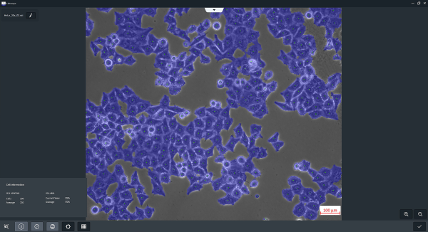 Interface du logiciel Labscope et de son module AI de comptage de cellules et de confluence