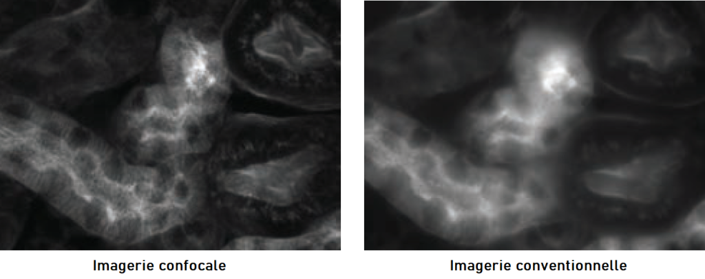 Comparaison Imagerie en fluorescence conventionnelle vs confocale